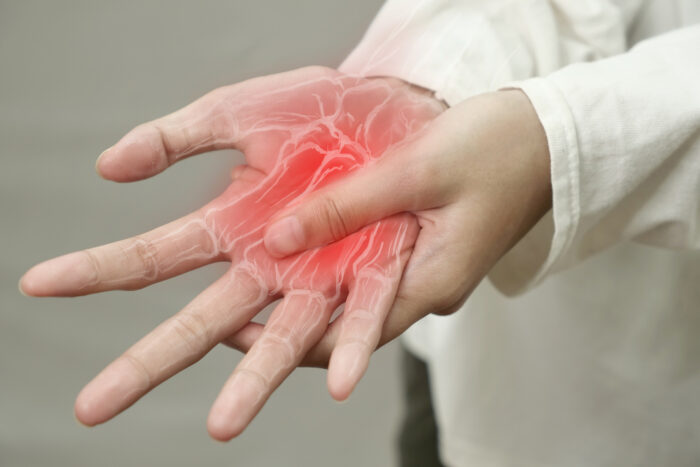 Trigger-Finger